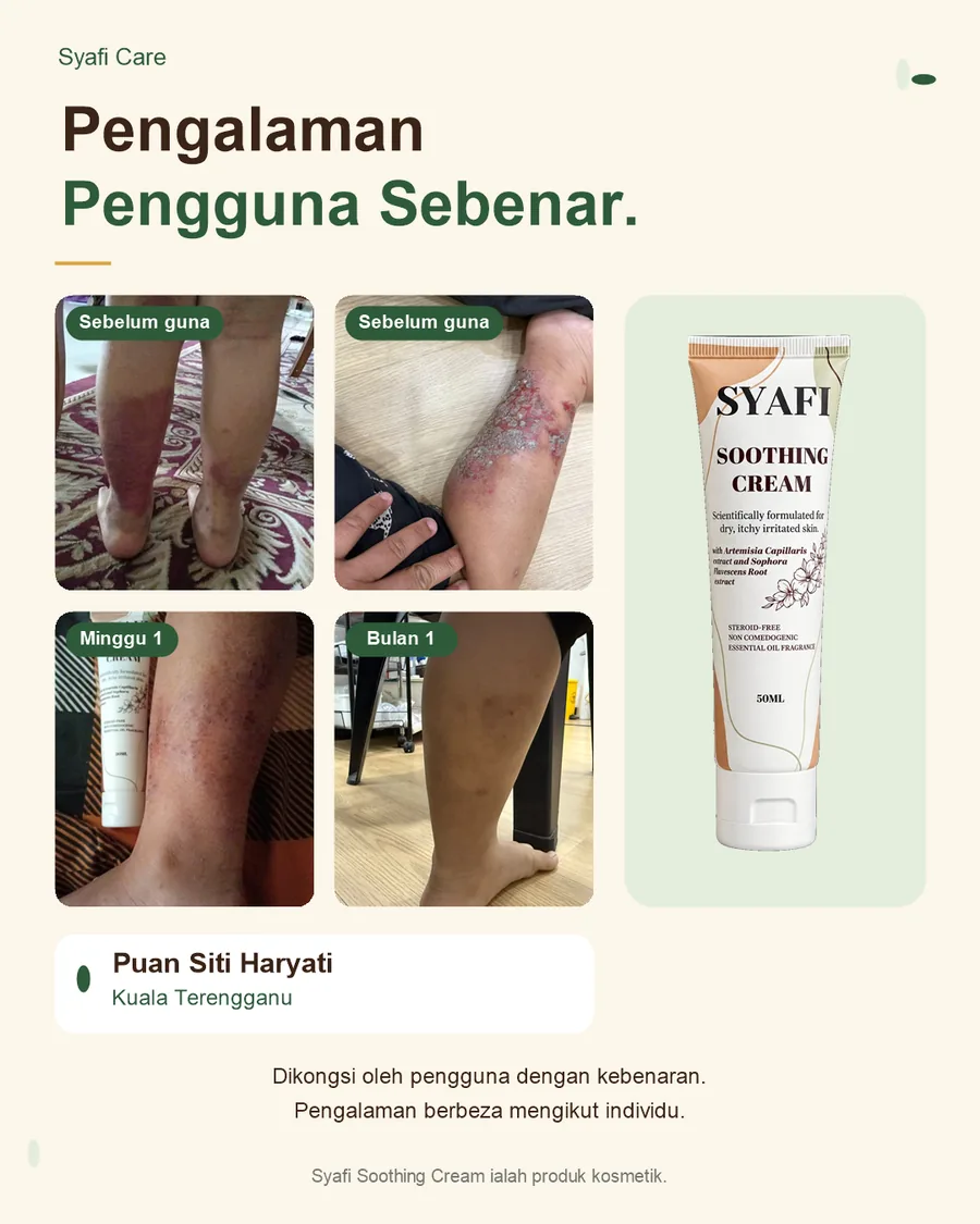 Pengalaman pengguna sebenar Syafi Soothing Cream, Puan Siti Haryati dari Kuala Terengganu: foto sebelum guna, minggu 1 dan bulan 1.